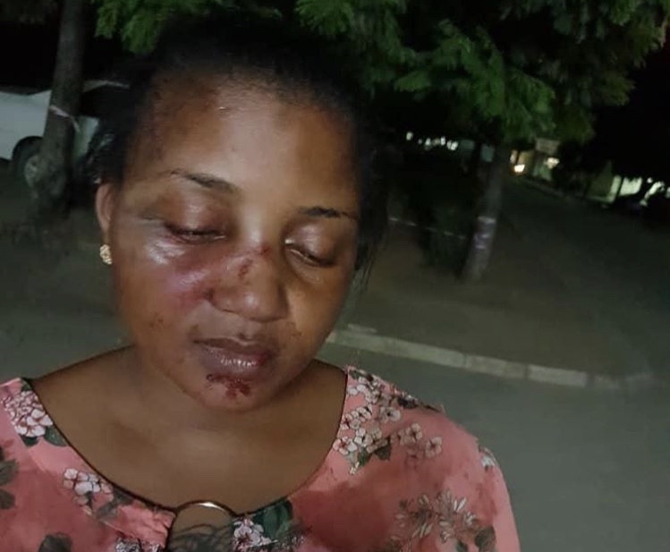 Tanzanian celebrities react to Shilole’s horrifying photos after receiving serious beating from husband