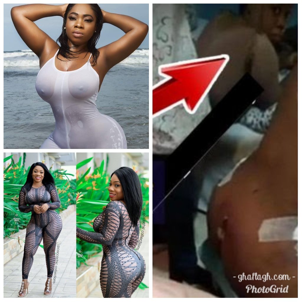 Photo Of When Moesha Boduong Was Having Her A$$ & B00bs Surgery
