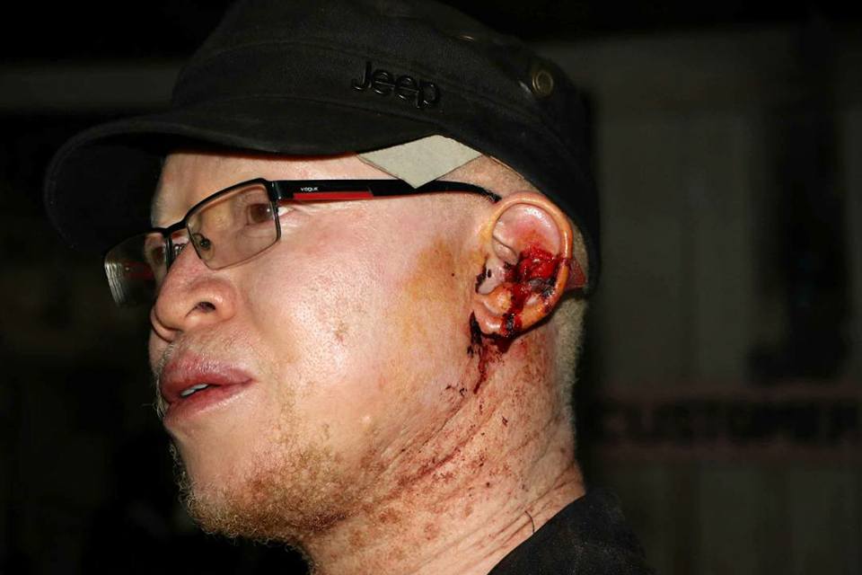 “Even after cutting your own ear with a razor blade you still lost?” Isaac Mwaura’s concession speech attracts hate and criticisms