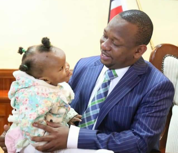 Mike Sonko steps up to support a 1 year old baby girl in urgent need of eye surgery