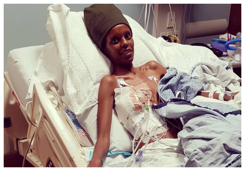 Keep on fighting girl! Heartbreaking photos of Njambi Koikai in US hospital with several tubes inserted in her chest