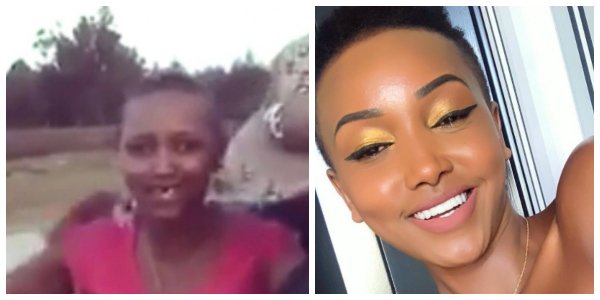 Huddah finally explains what happened to her tooth and how she managed to fix it