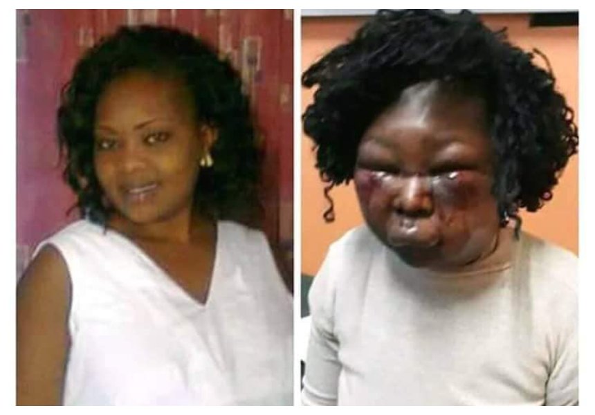 Photos of Eldoret man who battered pregnant wife for three hours leaving her face completely disfigured
