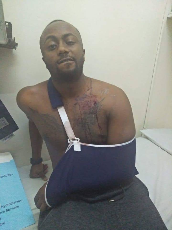 Photos of Joe Irungu showing gunshot wounds while wearing a bad-boy face leaves many angered