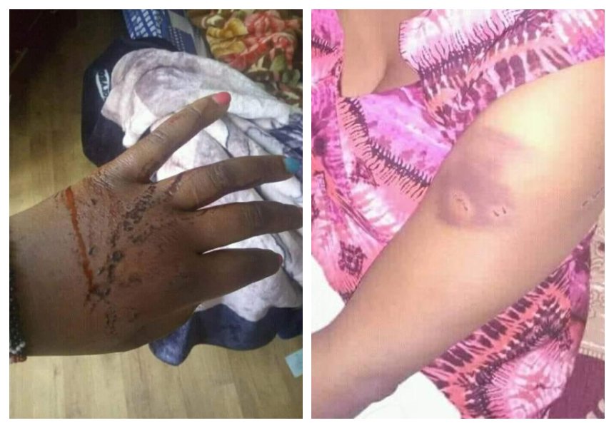 MP Gabriel Kago brutally beats wife after she confronts him about infecting her with STI thrice in a year (Photos)