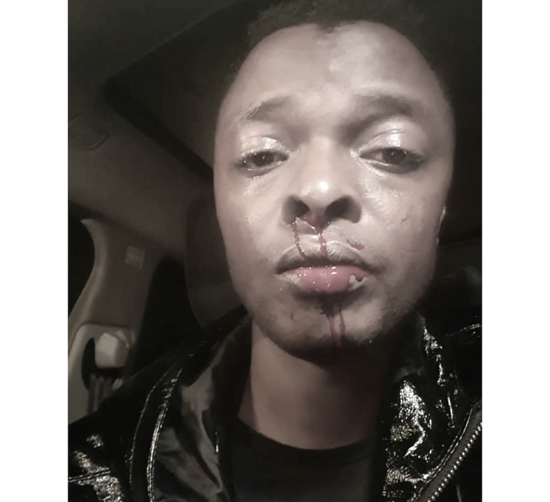 Ringtone beaten black and blue after gate crushing private party in Runda