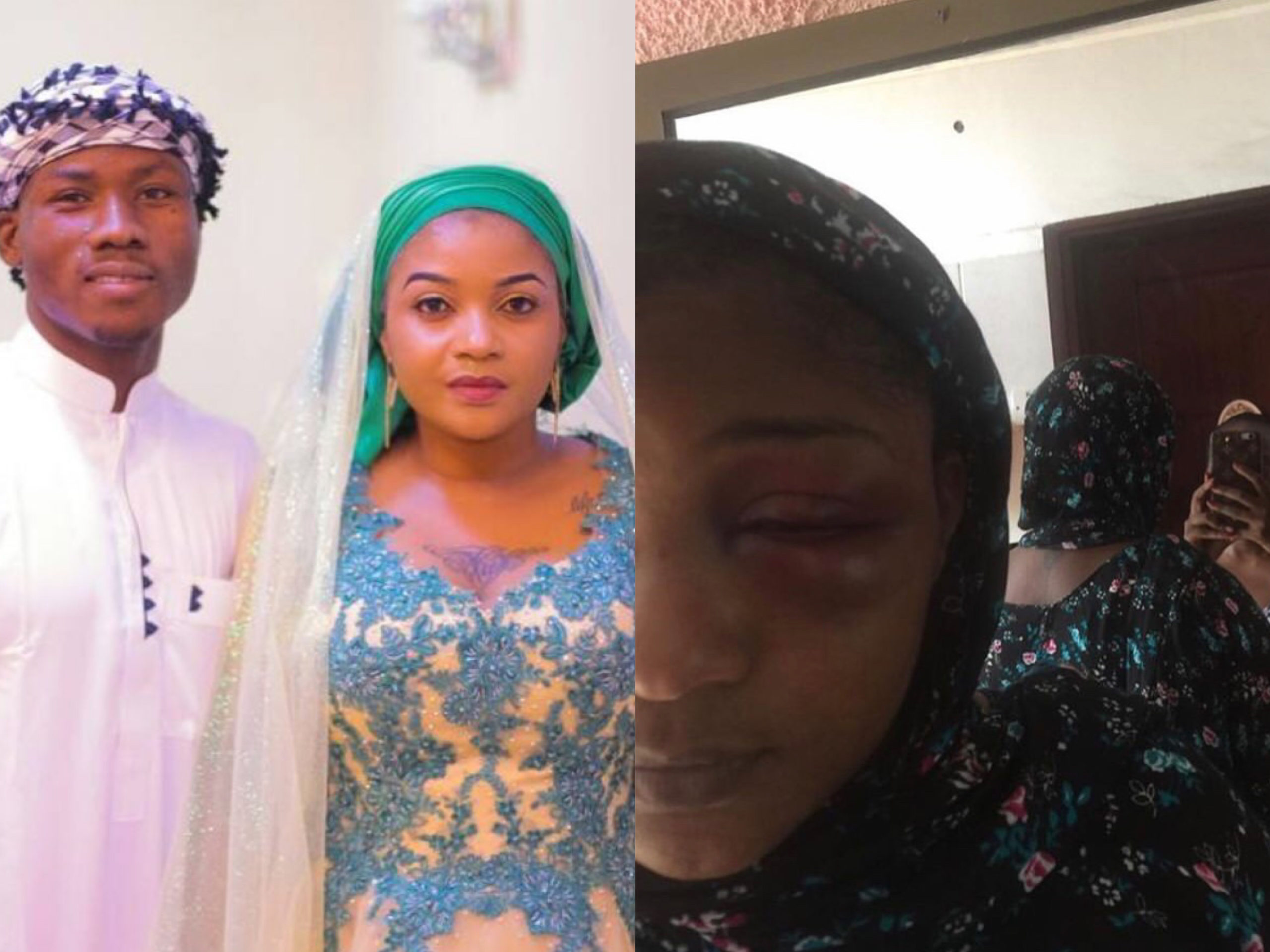 Shilole left looking unrecognizable after receiving serious beating from young husband (Photos)