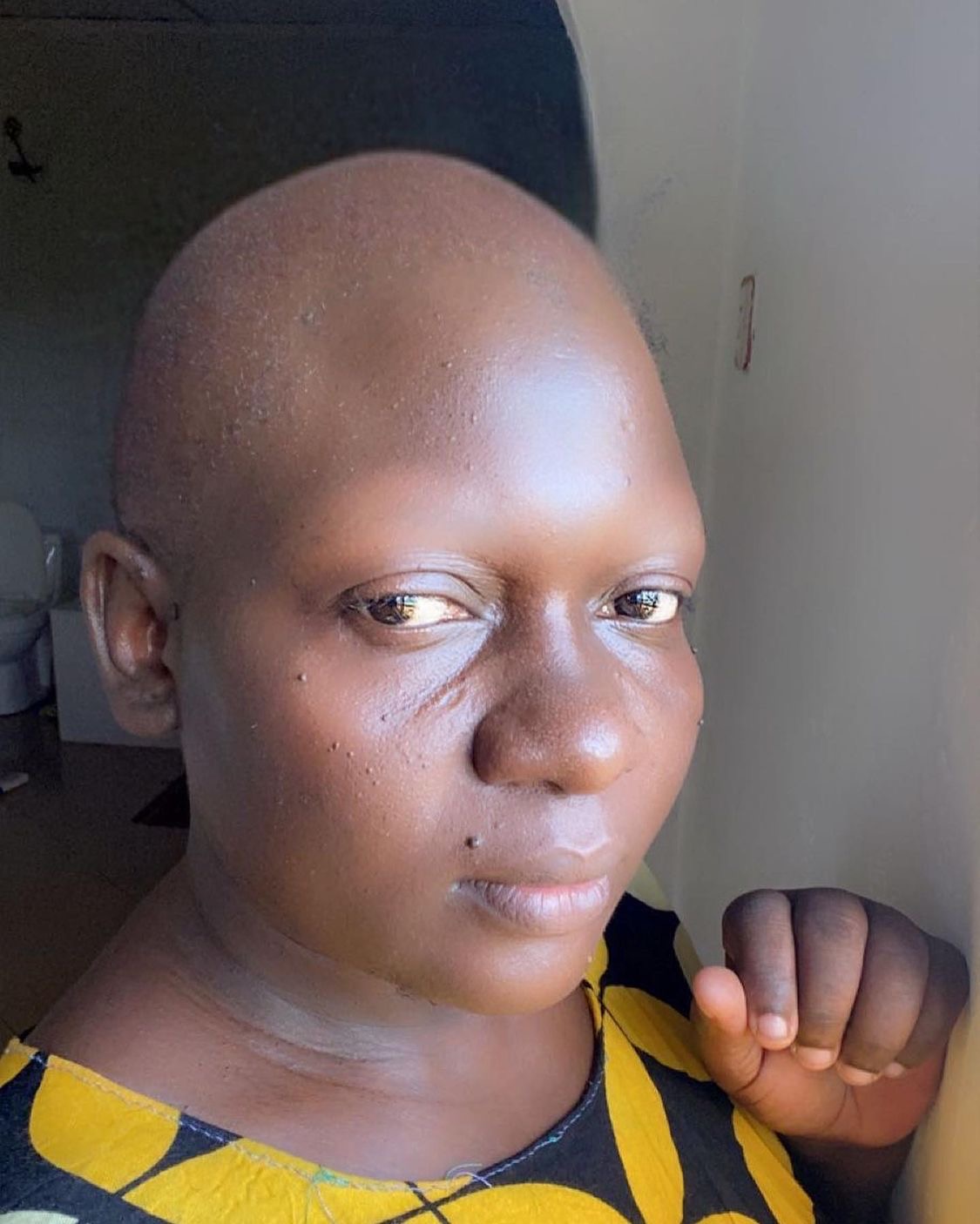 Bald is beautiful: Nyota Ndogo explains reasons behind her bold bald new look