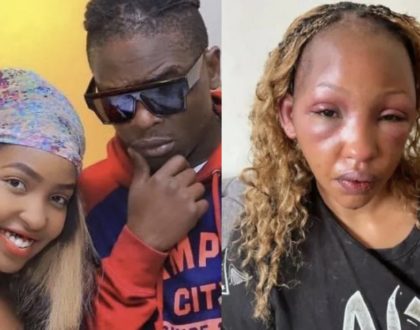 Chameleone's small brother Weseal accused of beating baby mama like a drum leaving her looking unrecognizable (Photos)