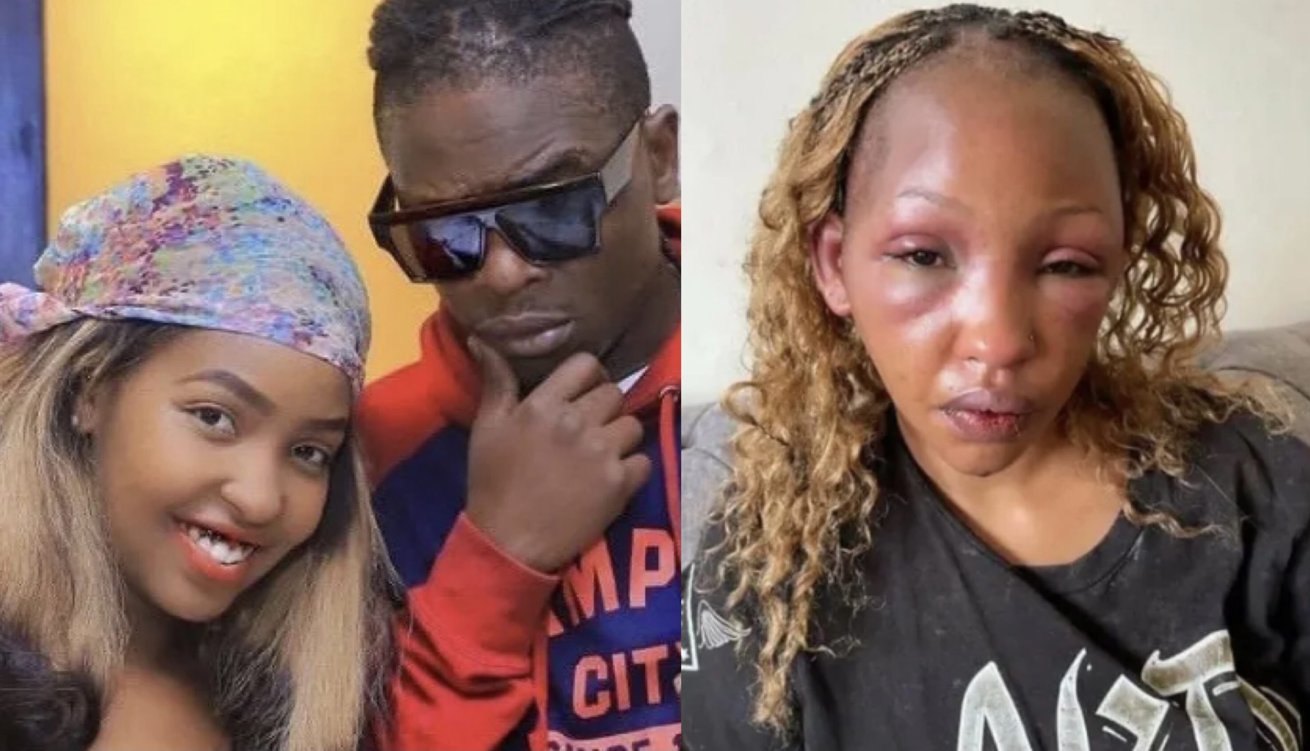 Chameleone's small brother Weseal accused of beating baby mama like a drum leaving her looking unrecognizable (Photos)