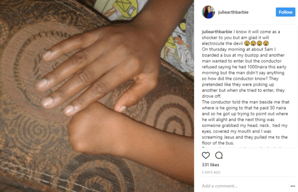 Youth Corps Member Escapes Ritualists Thanks to her Physical Deformity
